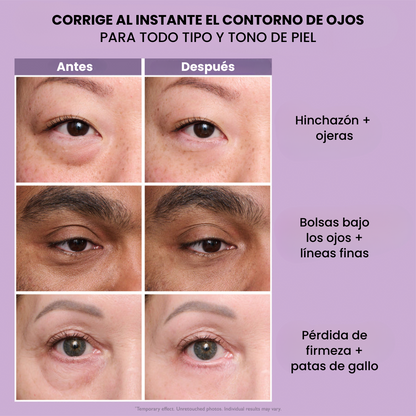 MiradaLuz™ - Ajustada de Ojos Instantáneo